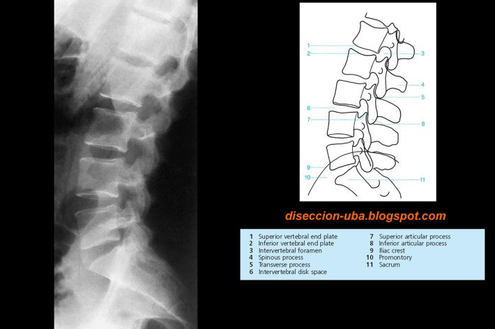 columna lumbar