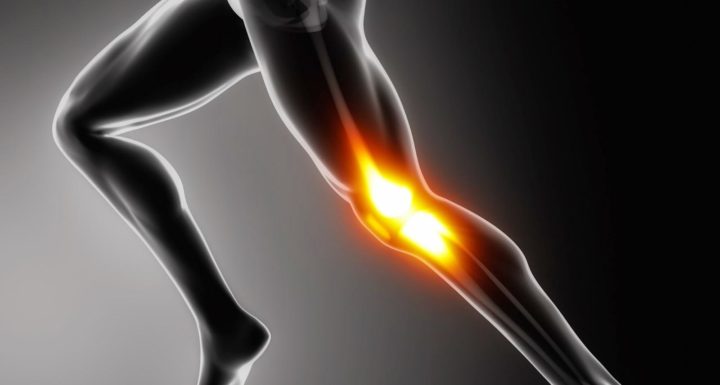 Es normal el dolor anterior de rodilla en un runner.