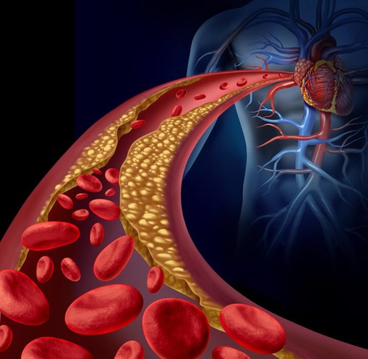 Efectos de los triglicéridos en el cuerpo