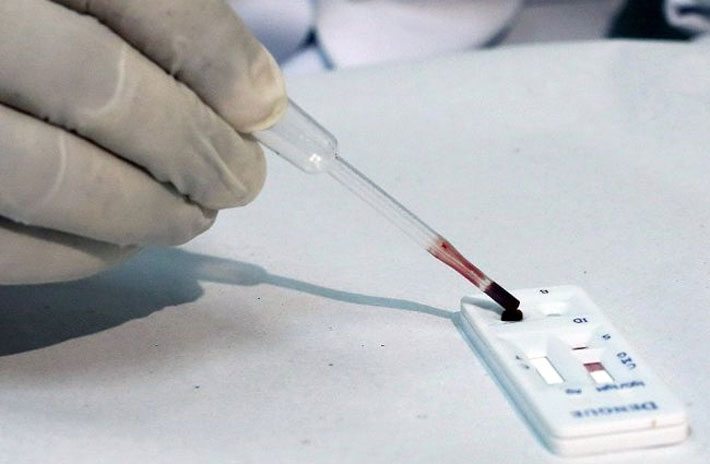 Cómo se contrae el virus del Zika