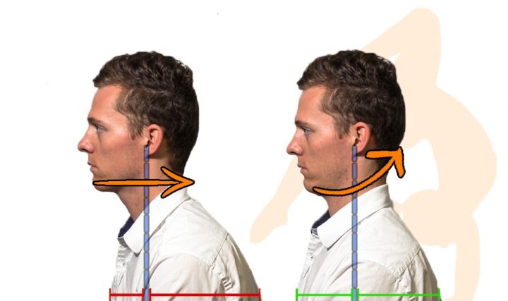 Retracción cervical