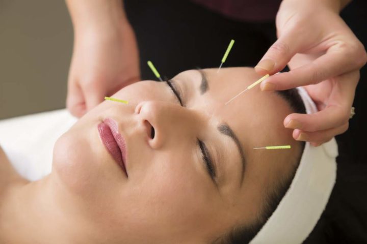 La electroacupuntura es beneficiosa para la salud