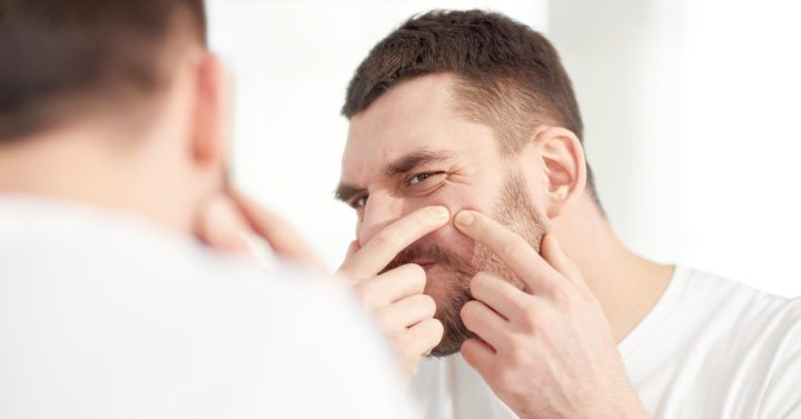 Tratamientos naturales para eliminar el acné