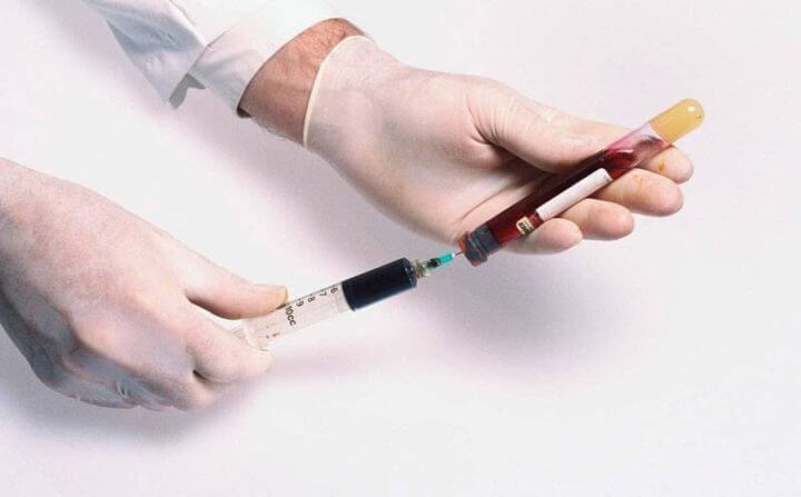 Las mejores ventajas del carbón activado