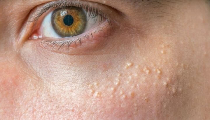 señales en el rostro de problemas de salud