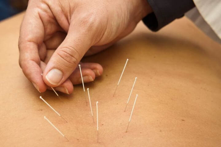 Prácticas extrañas de la medicina tradicional china 