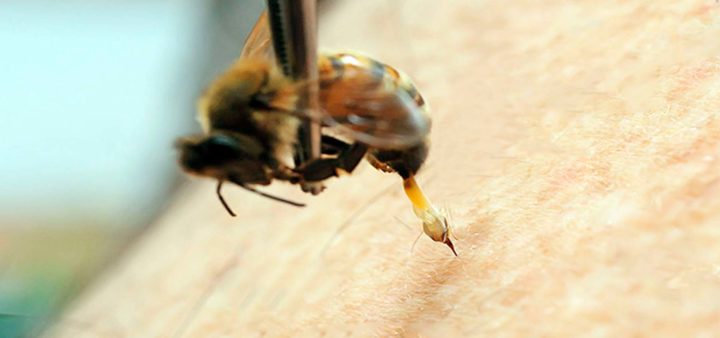 Beneficios de la apiterapia