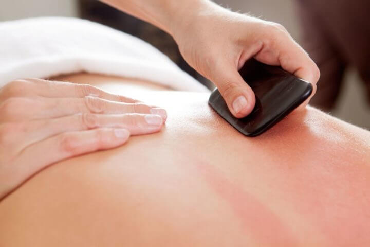 El Gua Sha es una práctica común en China 