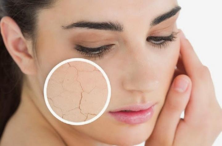 Piel seca por carencia de vitamina A