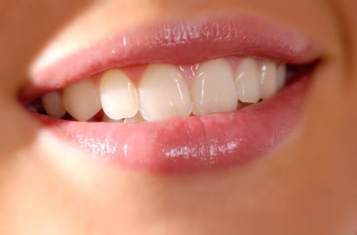 Viabilidad de los sensores dentales rastreadores de alimentos