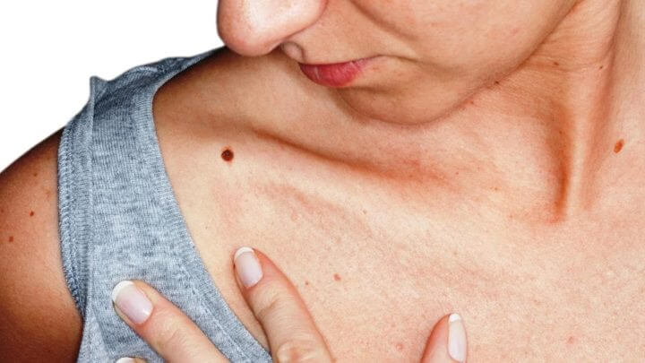Las setas chaga pueden prevenir y ayudar contra el cáncer