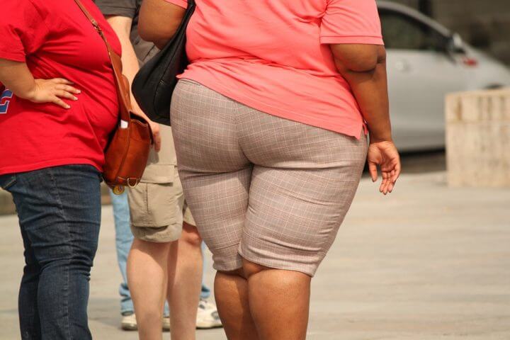 La obesidad es uno de los efectos de la malnutrición