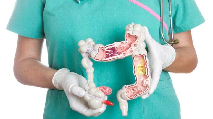 Beneficios de la dieta del microbioma