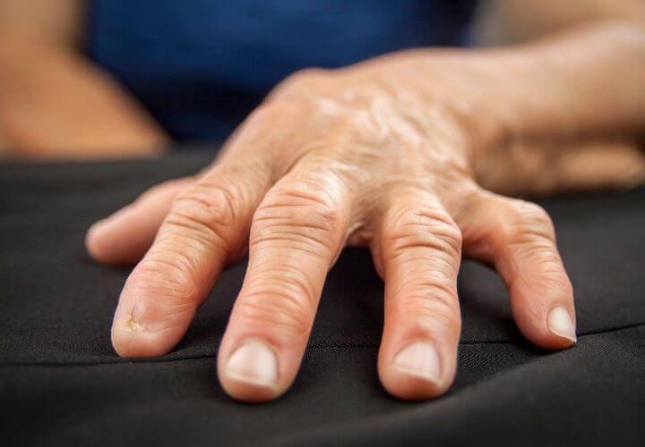 La garra de gato combate la osteoartritis