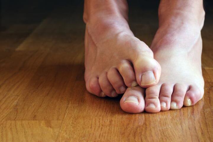Mal olor en los pies en los hombres