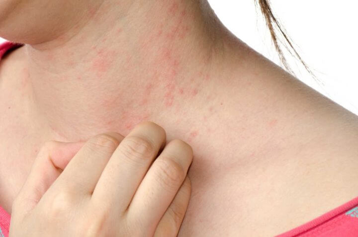 Las semillas de ajowan combaten las bacterias