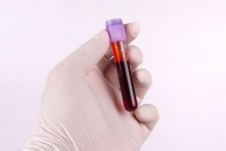 Cómo afecta el ejercicio físico al cáncer