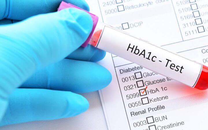 ¿Cuáles son los niveles adecuados de azúcar en sangre?