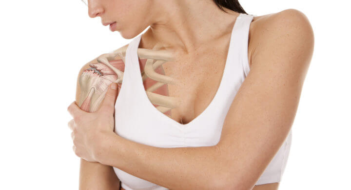 ¿Qué pasa si tengo una lagrima labral?