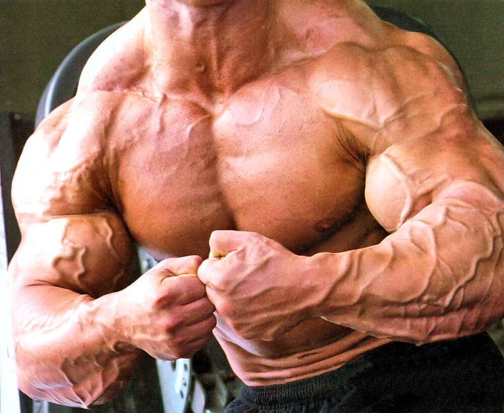 cuerpo vigoréxico