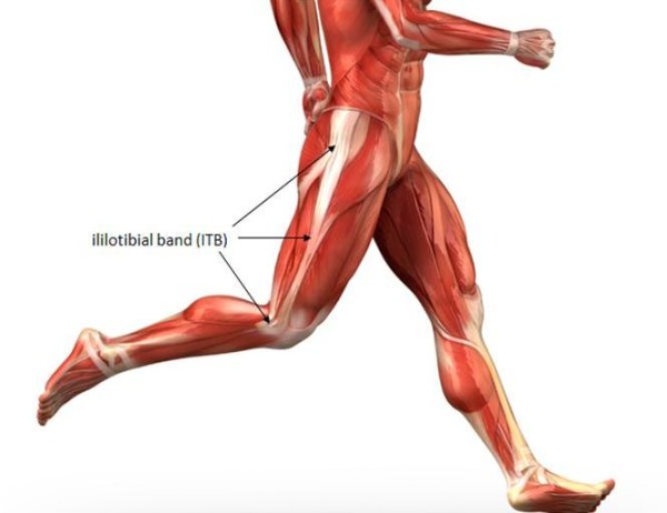 ITB ITBS síndrome cintilla iliotibial