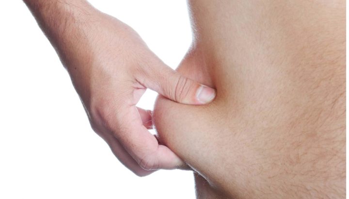 Debes deshacerte de la piel suelta para lucir tu cuerpo