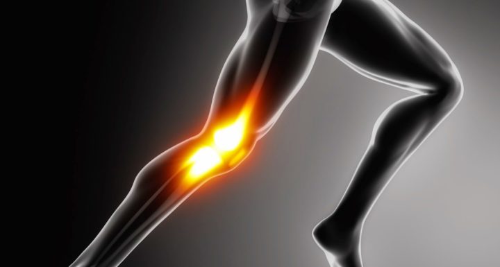 Cómo trata el síndrome de la cintilla iliotibial