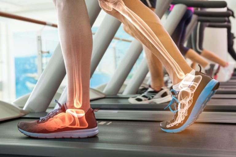 Errores al entrenar que pueden dañar tus articulaciones