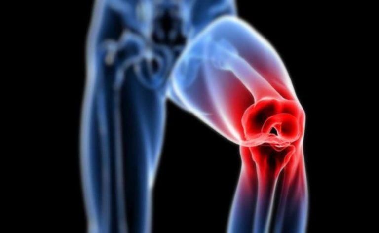 Dolor de rodilla y el entrenamiento