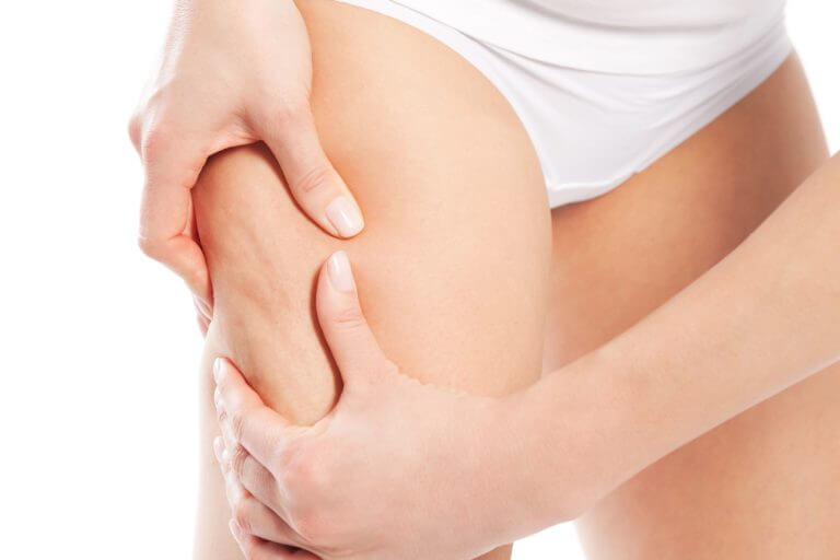 Guía definitiva sobre la celulitis