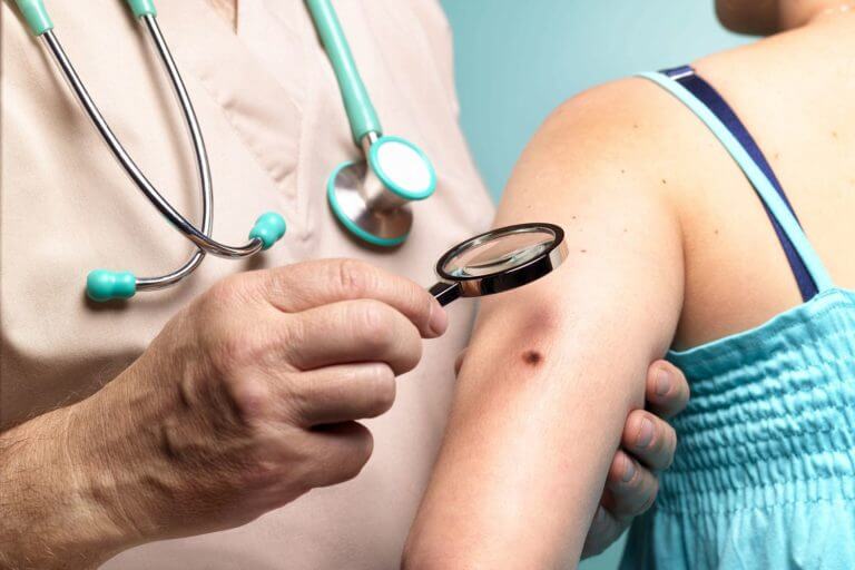 Diagnóstico y prevención del cáncer de piel