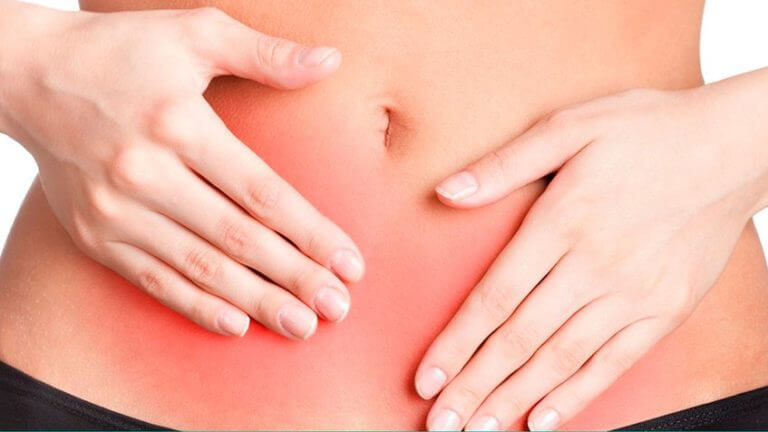 ¿Cómo combatir la endometriosis?