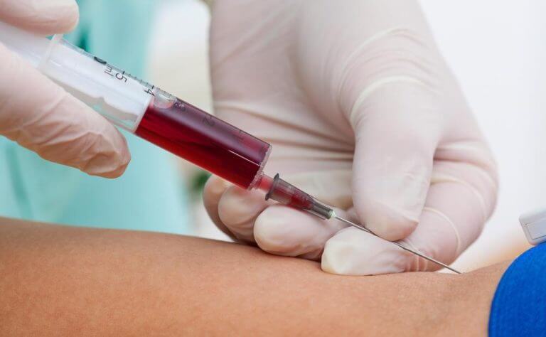 Guía de la terapia vitamínica intravenosa