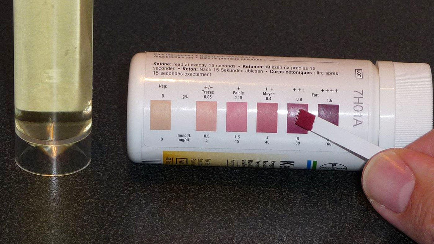 high-blood-sugar-and-ketones-off-66