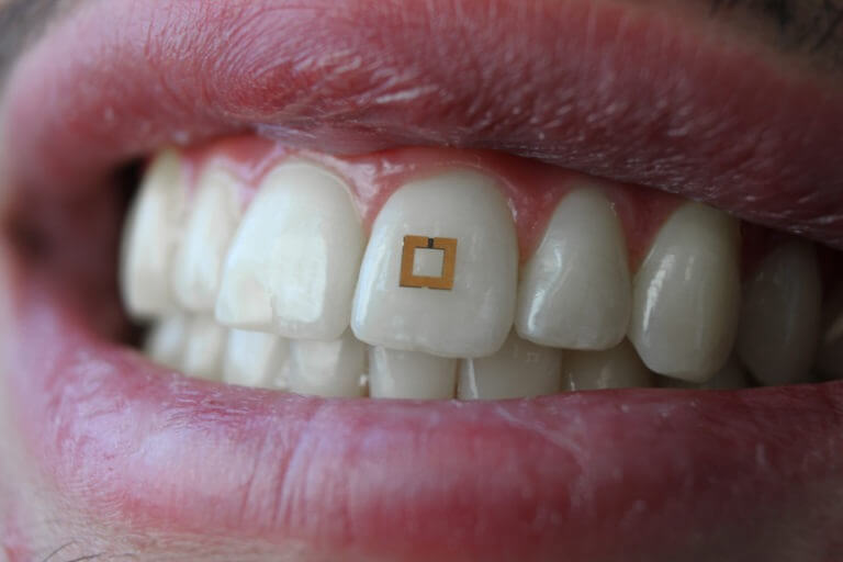 ¿Puedes adelgazar con los sensores dentales?