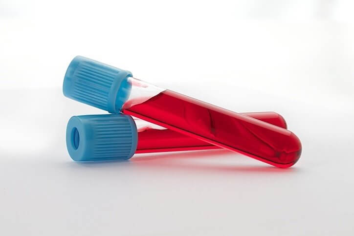 Guía para interpretar analíticas de sangre