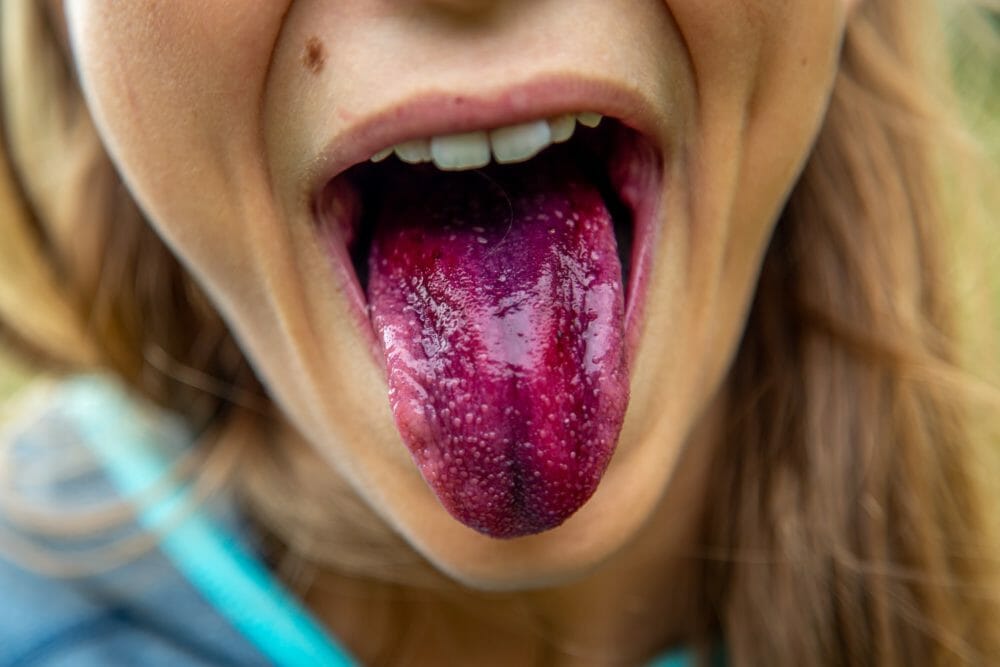 lengua