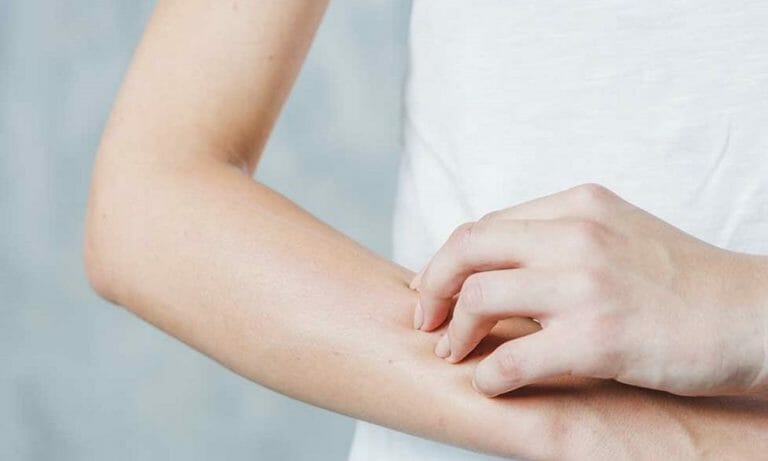 qué es esclerodermia